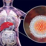 Hepatitis: Ayurveda has better treatment of hepatitis, follow these tips for healthy liver